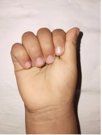 A child's hand forms the letter 'A' in Colombian Sign Language, an early step in learning to communicate through signs.